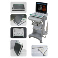 3D Laptop Ultrasound Machine for women with baby